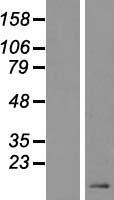 DEFB119 Human Over-expression Lysate