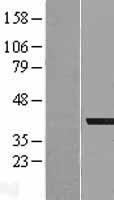 AKR1A1 Human Over-expression Lysate