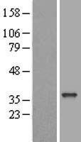 ELMOD2 Human Over-expression Lysate