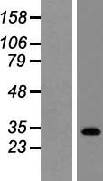 GPBAR1 Human Over-expression Lysate