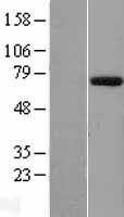 EYA1 Human Over-expression Lysate