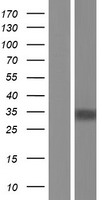 TGIF (TGIF1) Human Over-expression Lysate