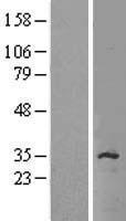 SLC35C2 Human Over-expression Lysate