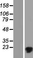 MMGT1 Human Over-expression Lysate