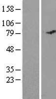 C19orf21 (MISP) Human Over-expression Lysate