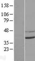 CNTD (CNTD1) Human Over-expression Lysate