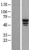 Tryptophanyl tRNA synthetase (WARS) Human Over-expression Lysate
