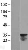 NSE2 (NSMCE2) Human Over-expression Lysate
