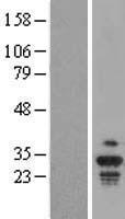 KRT18P55 Human Over-expression Lysate