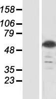 C8orf47 (ERICH5) Human Over-expression Lysate