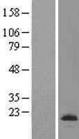VKORC1L1 Human Over-expression Lysate