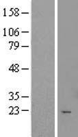 TTC9C Human Over-expression Lysate