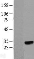 N6AMT2 (EEF1AKMT1) Human Over-expression Lysate