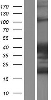SH3D20 (ARHGAP27) Human Over-expression Lysate