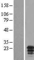 MCEMP1 Human Over-expression Lysate