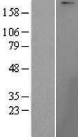 UBR1 Human Over-expression Lysate