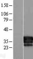 LRATD2 Human Over-expression Lysate