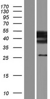 ST3GAL3 Human Over-expression Lysate
