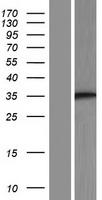 ST3GAL3 Human Over-expression Lysate