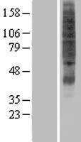 SVOPL Human Over-expression Lysate
