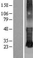 KRTCAP3 Human Over-expression Lysate