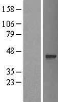 C17orf101 (OGFOD3) Human Over-expression Lysate