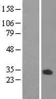 ODF3L1 Human Over-expression Lysate