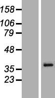 MAGEA6 Human Over-expression Lysate