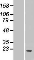PPFIBP1 Human Over-expression Lysate