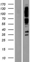 Liprin alpha 1 (PPFIA1) Human Over-expression Lysate