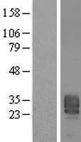 Phosphatidic acid phosphatase type 2B (PLPP3) Human Over-expression Lysate