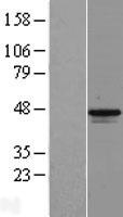 MAGEB1 Human Over-expression Lysate