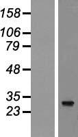 nkx6.2 (NKX6-2) Human Over-expression Lysate