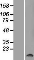 T2R50 (TAS2R50) Human Over-expression Lysate