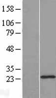 DHFRL1 (DHFR2) Human Over-expression Lysate
