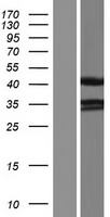 PDLIM2 Human Over-expression Lysate