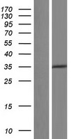 PPP2R4 (PTPA) Human Over-expression Lysate