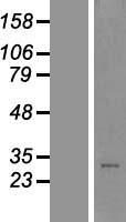 C1orf201 (STPG1) Human Over-expression Lysate