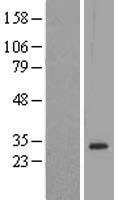 DLX1 Human Over-expression Lysate