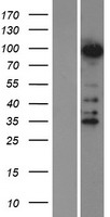 ZNF598 Human Over-expression Lysate