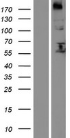 FUT8 Human Over-expression Lysate
