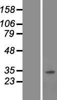 SNAI3 Human Over-expression Lysate