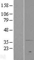 MPRA (PAQR7) Human Over-expression Lysate