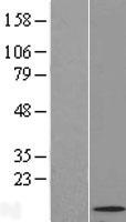 GMCL1 Human Over-expression Lysate