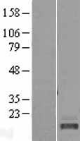 C20orf85 Human Over-expression Lysate