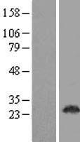 EAN57 (TEX33) Human Over-expression Lysate