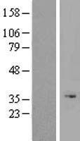 ODAPH Human Over-expression Lysate