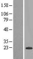 C20orf79 (SCP2D1) Human Over-expression Lysate