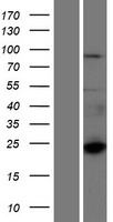 CTAGE6 Human Over-expression Lysate