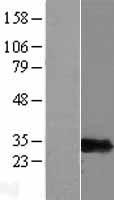 PSMF1 Human Over-expression Lysate
